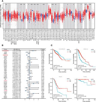 USP20 is a predictor of poor prognosis in colorectal cancer and associated with lymph node metastasis, immune infiltration and chemotherapy resistance